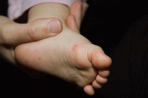 У дитсадку на Тернопільщині 32 дитини заразились невідомою хворобою