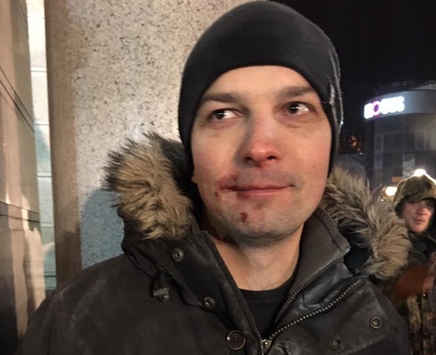 Під час зіткнень у центрі Києва побили нардепа Соболєва