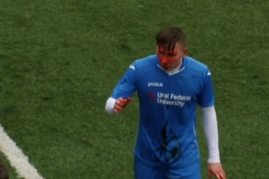 Чеченські футболісти побили суперника до крові під час матчу в Росії