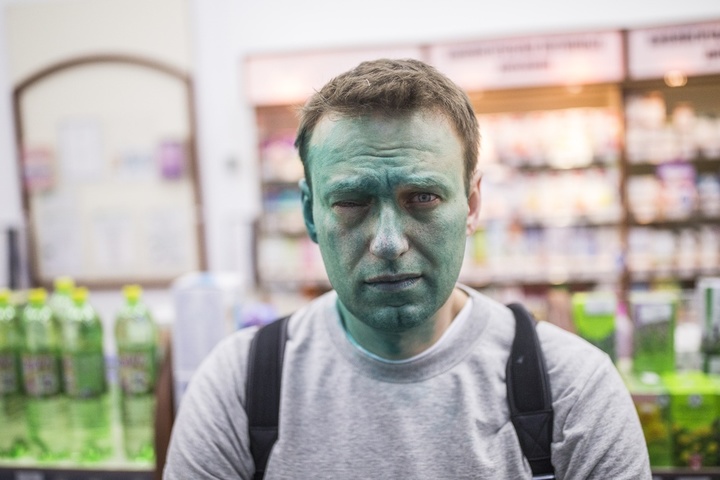 Навальний може ніколи повністю не відновити зір після нападу
