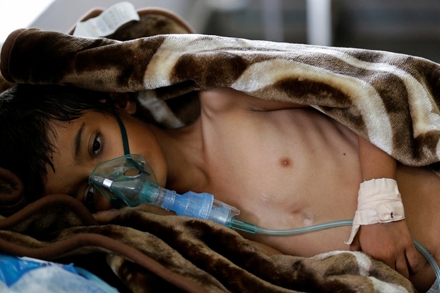 Спалах холери в Ємені: загинули вже 115 людей