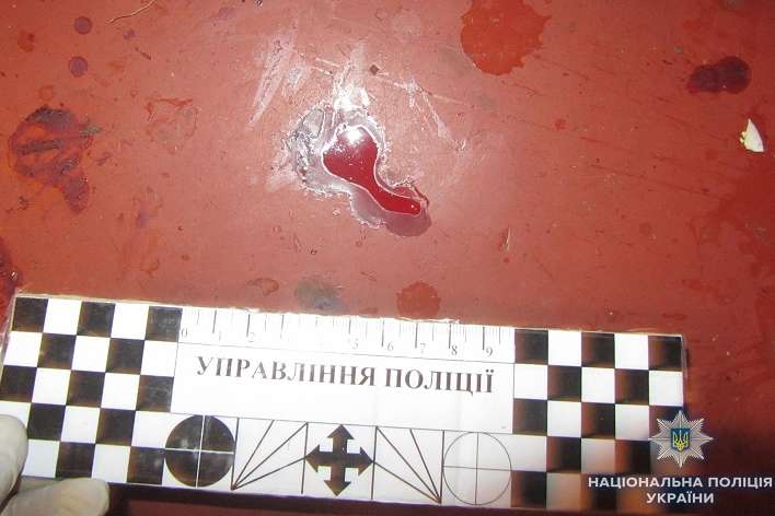 У Дарницькому районі жінка ножем поранила співмешканця