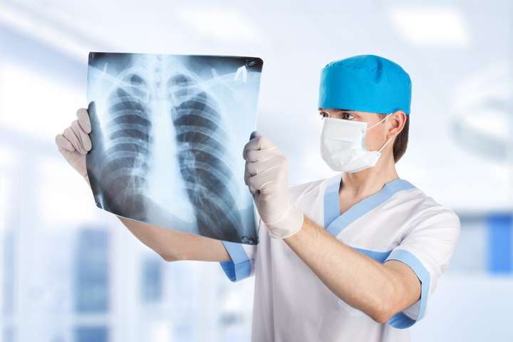 В Україні за десять років знизилася захворюваність на туберкульоз на 40%