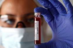 На Буковині підтвердили ще п'ять випадків зараження коронавірусом