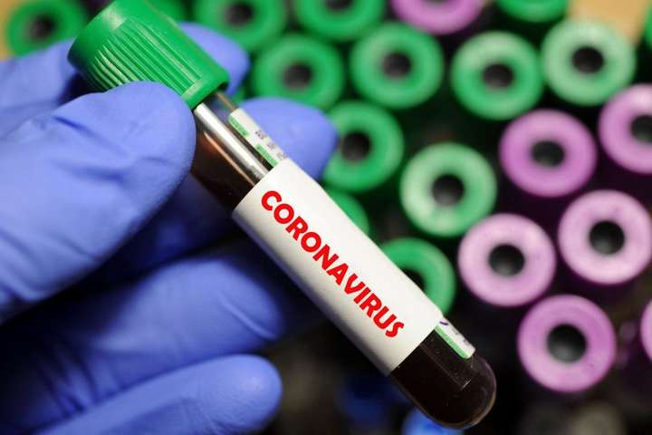 У Києві ще три нових випадки коронавірусу