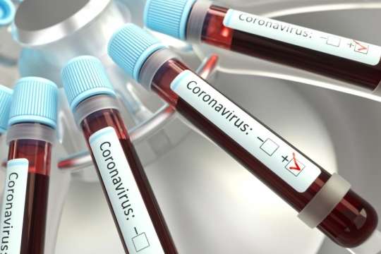  ���� ������ covid-19 ��� ��� ������� ������ ��� 