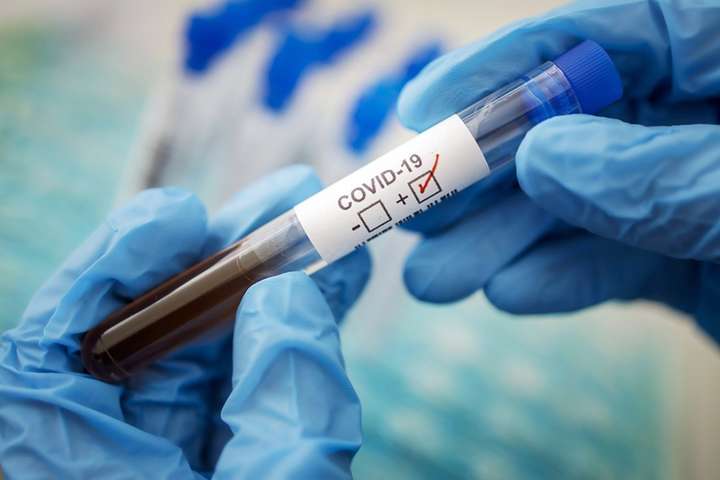  ���������� ���������� ����� ������� ��� ��� covid-19 