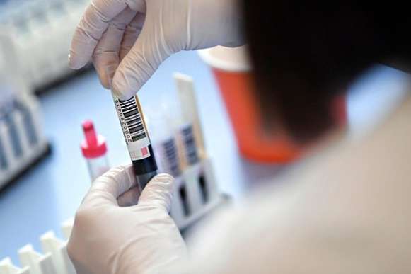В Індонезії померла провідна дослідниця вакцини Sinovac з підозрою на Covid-19 – ЗМІ