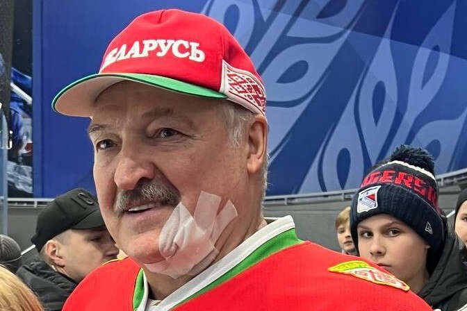 Лукашенку до крові розбили обличчя під час хокейного матчу (відео)