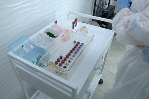 У Дніпропетровській області зареєстровано вже 32 випадки гепатиту А