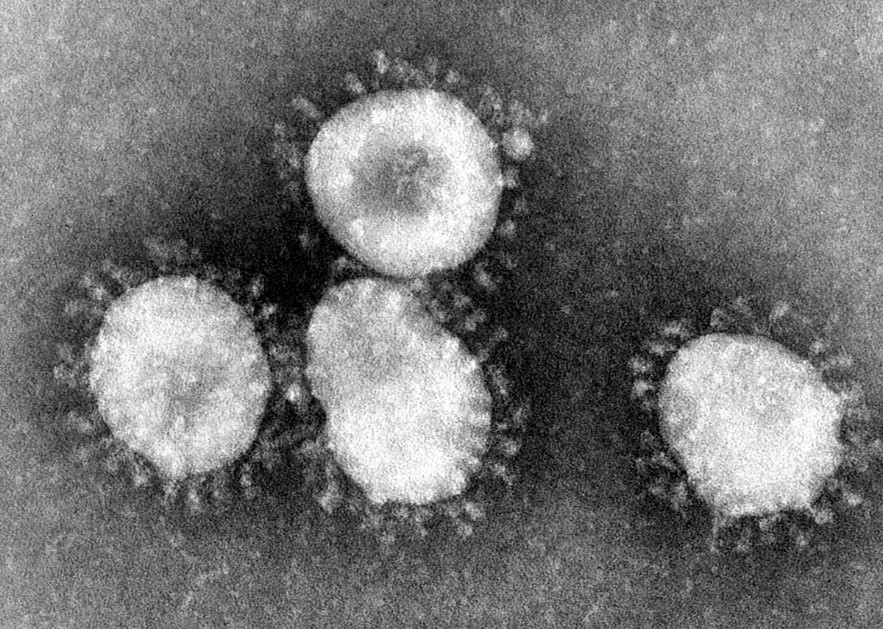 Коронавірусні інфекції найактивніше поширюються в осінньо-зимовий період