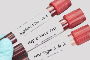 Інфікування чотирма хворобами, що передаються статевим шляхом становить понад 1 млн випадків щодня