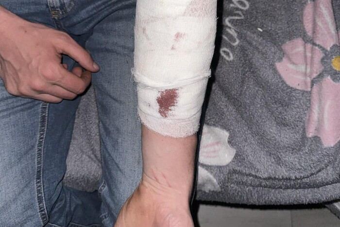 На Київщині чоловік після відвідин ТЦК порізав собі вени: військові прокоментували інцидент 