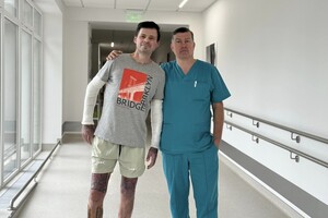 Обсмалював кабана до Великодня: лікарі врятували чоловіка, який отримав 40% опіків тіла