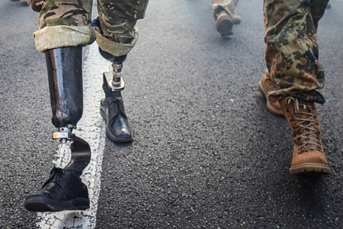 «Черги для військових на протезування немає». Як держава допомогає тим, хто втратив кінцівки