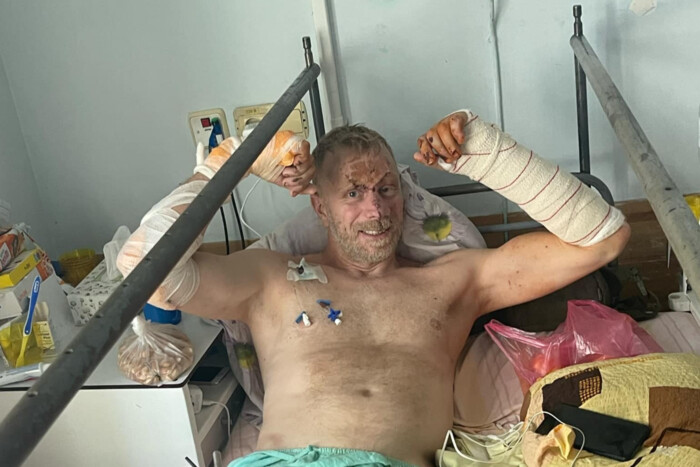 Актор Андрій Валенський отримав важкі поранення на фронті (фото)