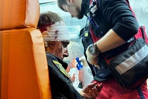 В результаті обстрілу 26 поліцейських Харківщини обримали поранення різного ступеня