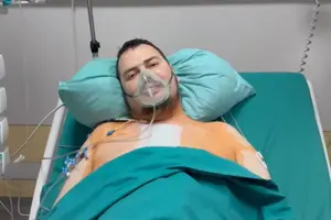 Унікальна операція. В Україні провели першу ретрансплантацію серця