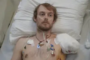 Едвард проходитиме подальше лікування та реабілітацію у Києві