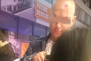 Постраждалий від нападу чоловік