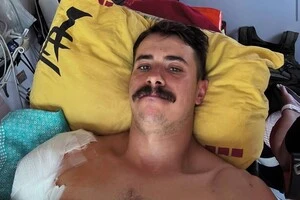 Син Грубича, який втратив руку на війні, звернувся до українців