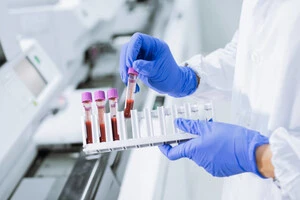 Фонд Карнегі: Світ демонструє тенденцію до зниження захворюваності на ВІЛ, тоді як у Росії вона зростає