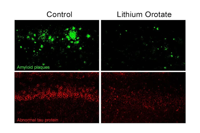 Вчені виявили простий спосіб зупинити розвиток Альцгеймера