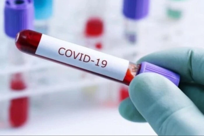 Чи є в Україні епідемія коронавірусу? Ляшко оцінив ситуацію