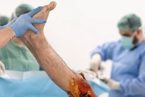 У Туреччині набуває популярності нова операція для чоловіків