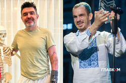 Як живеться пораненим на війні. Дві історії: позитивна і не дуже