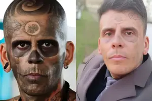 Понад 170 тату: бризилієць два роки позбувався татуювань на обличчі