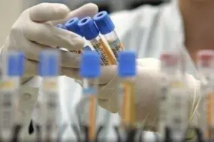 Російську армію накрила неконтрольована епідемія ВІЛ та гепатиту