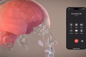 Neuralink анонсувала технологію швидкого перетворення думок на текст