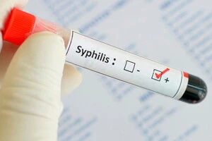 У Німеччині зафіксовано рекордну кількість випадків зараження сифілісом