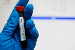 Учасники чемпіонату світу з важкої атлетики перевірятимуться на допінг новим методом