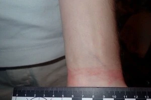 Киянин став жертвою розбійного нападу після онлайн-знайомства з юнаком 