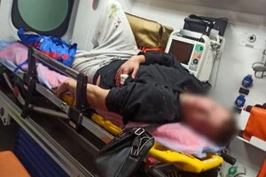 Після нападу зловмисник намагався втекти, але впав і зламав ногу