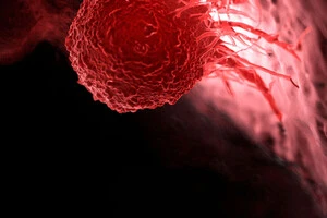 Як штучний інтелект може допомогти у лікуванні раку