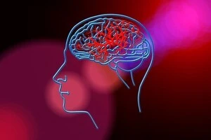 Запалення ясен назвали неочевидним провісником інсульту