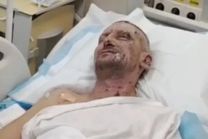 Вбивство журналістів телеканалу Freedom. Медійник, який пережив атаку РФ, розповів деталі