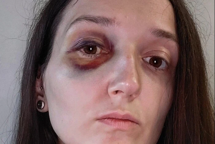 На Львівщині неповнолітній побив жінку в трамваї. Поліція почала розслідування