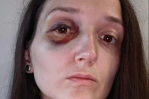 На Львівщині неповнолітній побив жінку в трамваї. Поліція почала розслідування