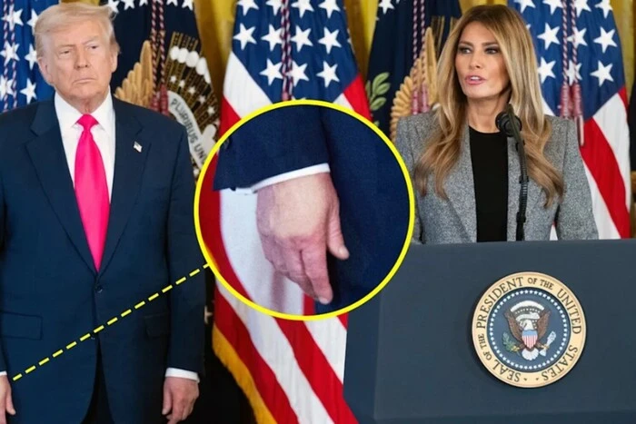 Трамп знову замаскував синець на руці тональним кремом