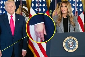 Трамп знову замаскував синець на руці тональним кремом