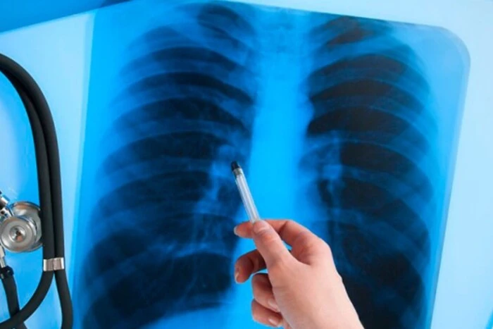 ВООЗ назвала головний вірус-вбивцю