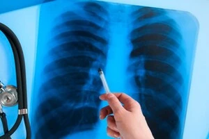 ВООЗ назвала головний вірус-вбивцю 