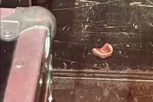 На концерті артиста невідомий загубив щелепу