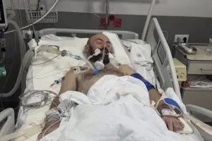 Після тривалого лікування артист перебуває у комі