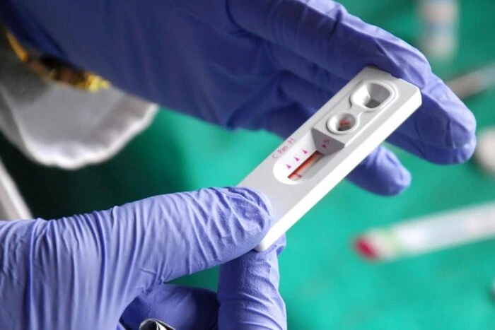 Безкоштовно та конфіденційно: де у Києві швидко перевіритися на ВІЛ та гепатити