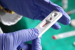 ВІЛ на ранніх стадіях не має симптомів. Близько 70% людей дізнаються про свій статус запізно